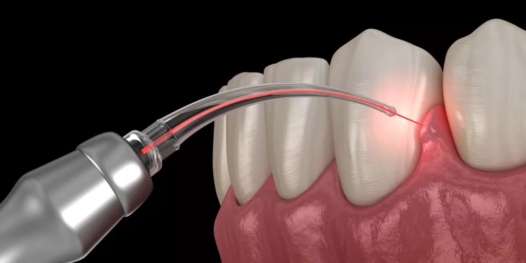 Periodontics Dentistry